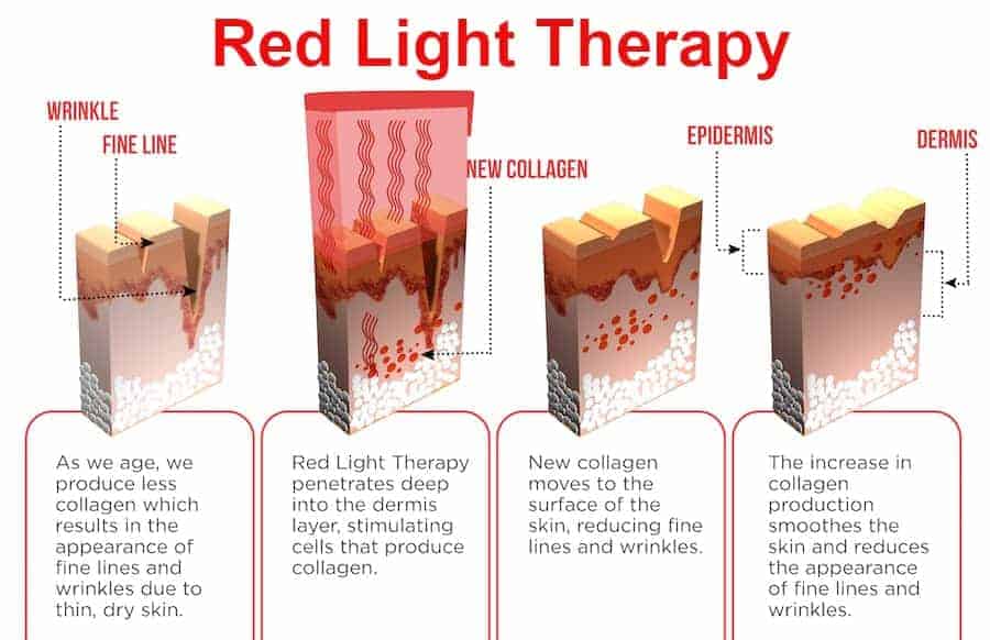 Collagen Production Using Red Light Therapy 